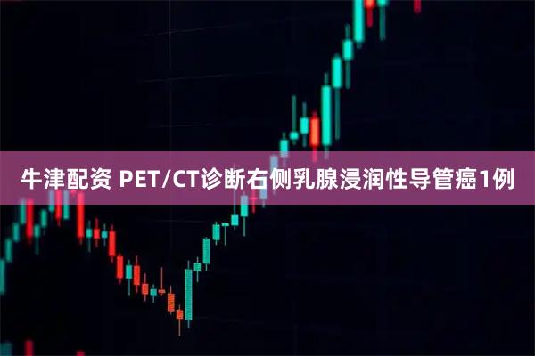 牛津配资 PET/CT诊断右侧乳腺浸润性导管癌1例
